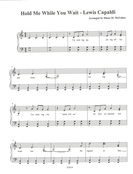 Hold Me While You Wait Sheet Music