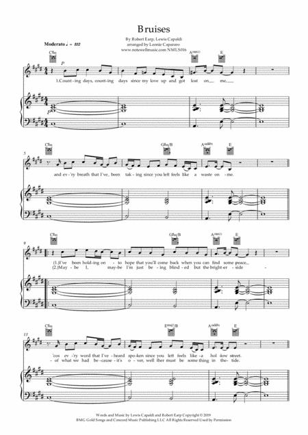 Bruises Pvg C Minor Male Voice Page 2