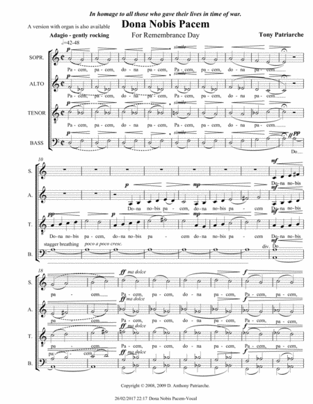 Una Furtiva Lagrima For Woodwind Quintet Sheet Music